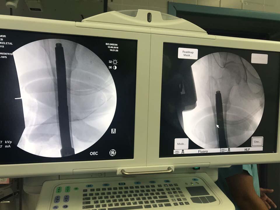 Фото: пресс-служба больницы "Бейлинсон" (Фото: пресс-служба больницы "Бейлинсон") Фото: пресс-служба больницы "Бейлинсон"