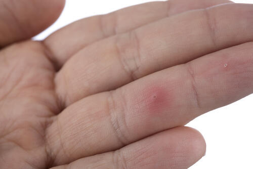 Фото: shutterstock