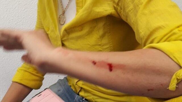 Подвергшаяся нападению соцработник nullnull Подвергшаяся нападению соцработник