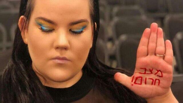 Netta Barzilai with the writing 'emergency situation' on her hand 