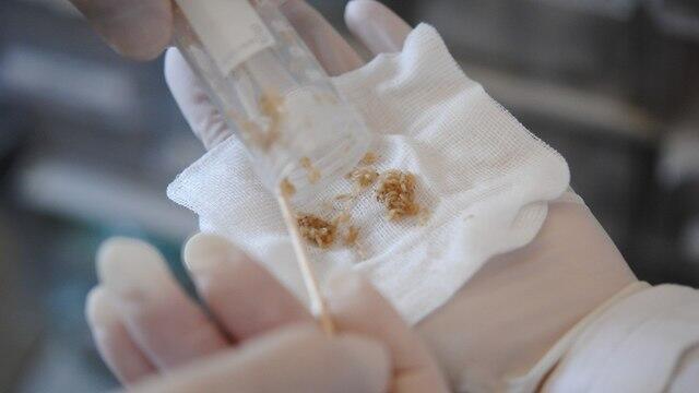 Лечебные личинки. Фото: Koko (צילום: Koko) Лечебные личинки. Фото: Koko