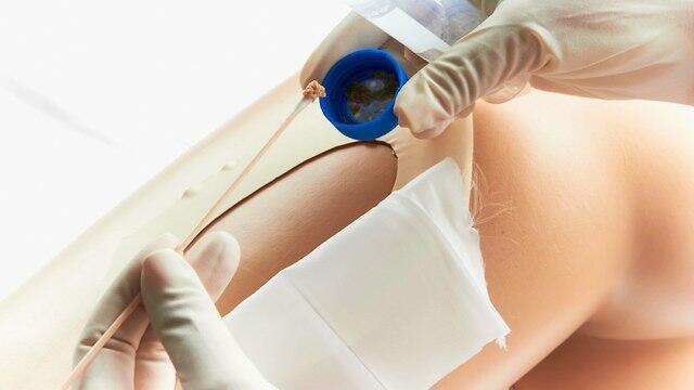 Так сажают стерильных личинок на раку. Фото: Koko (צילום: Koko) Так сажают стерильных личинок на раку. Фото: Koko