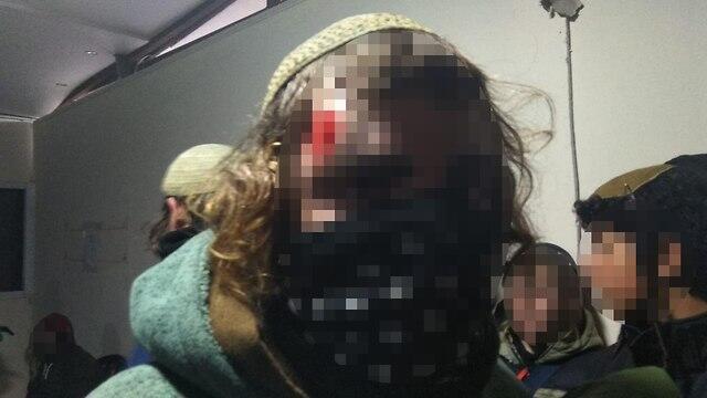 Фото: "Ноар Амона"