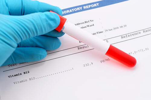 Фото: shutterstock (Фото: shutterstock) Фото: shutterstock