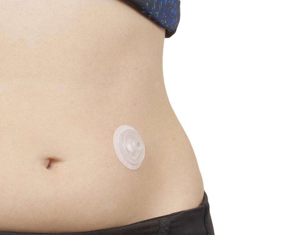 Колпачок остается на месте 3 дня, затем его меняют на новый Колпачок остается на месте 3 дня, затем его меняют на новый