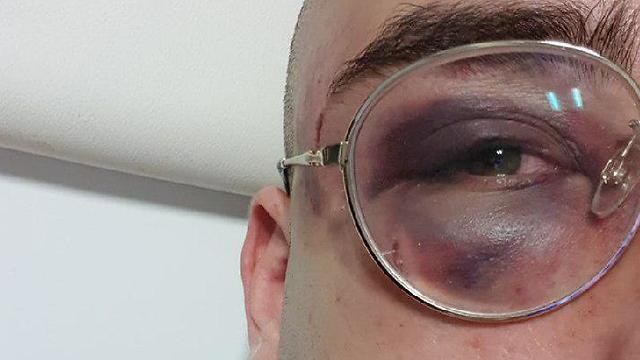 Пострадавший Идо Меир