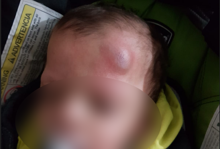 Пострадавший ребенок. Фото: mynet