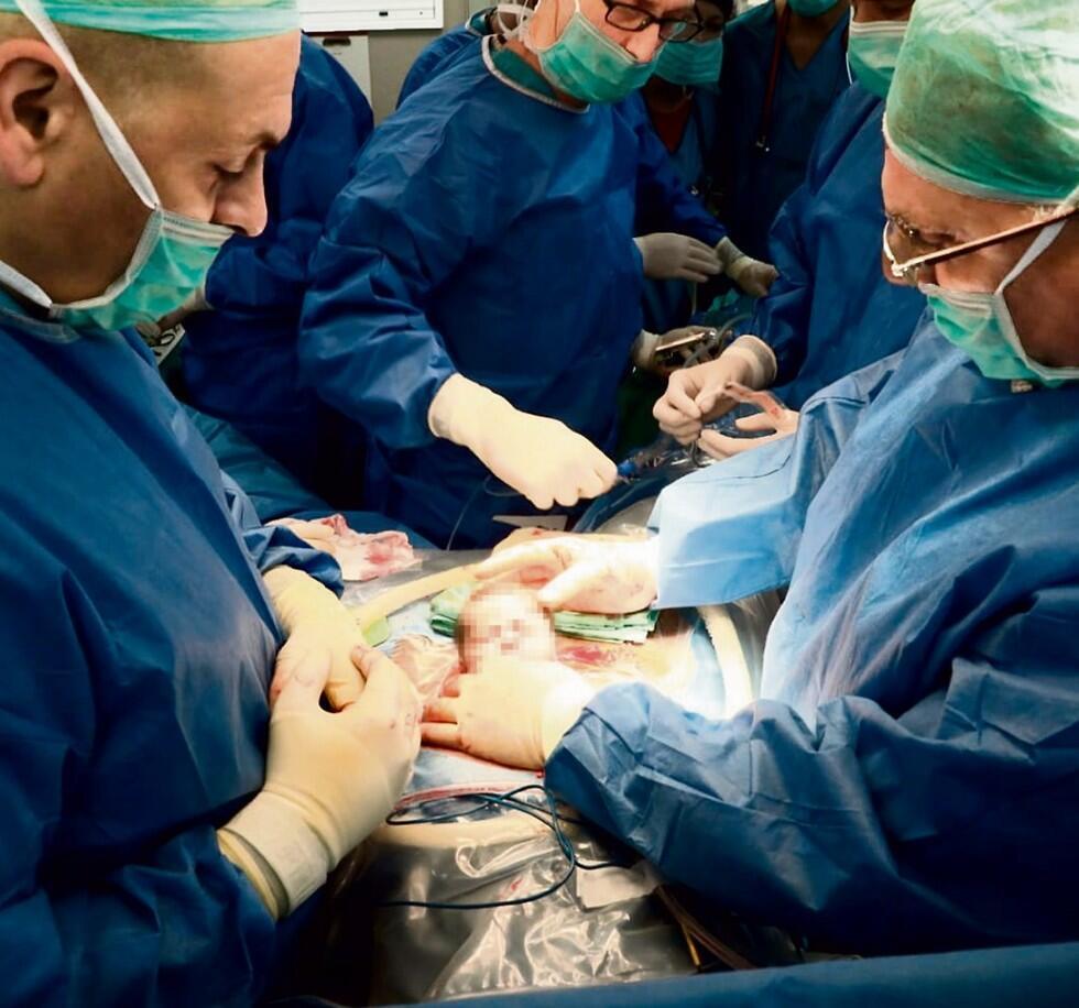 Головка плода снаружи, тельце в матке - редкая операция в больнице "Рамбам". Фото: прессс-лужба Головка плода снаружи, тельце в матке - редкая операция в больнице "Рамбам". Фото: прессс-лужба