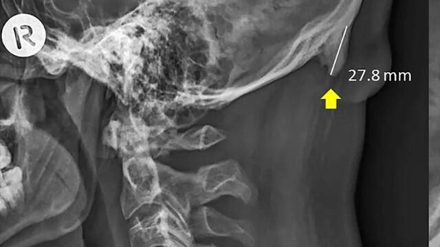 Рентгенограмма: Scientific Reports