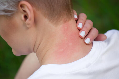 Фото: shutterstock