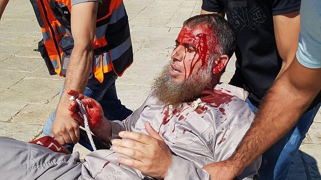 A Muslim worshipper is wounded during clashes with police on Temple Mount, August 11, 2019