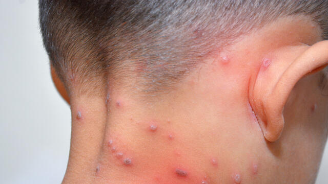 Фото: shutterstock