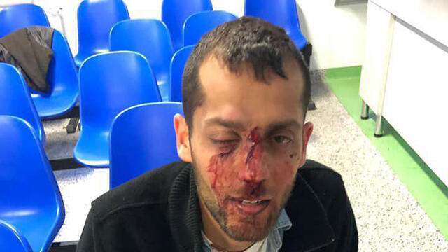 Yotam was attacked on saturday in Warsaw