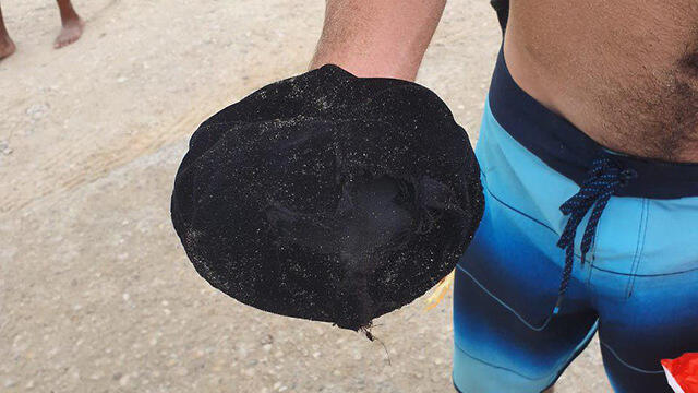 Kippah worn by Asher Hazut who was struck by lightningnullnull Kippah worn by Asher Hazut who was struck by lightning