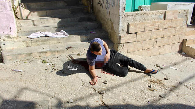 Омар после ранения