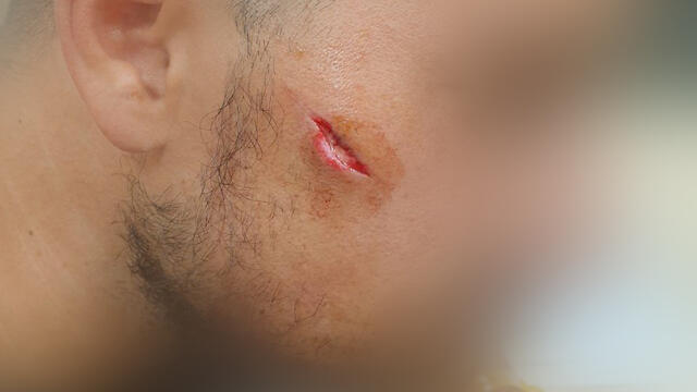 Пострадавший сотрудник Управления аэропортовnullnull Пострадавший сотрудник Управления аэропортов