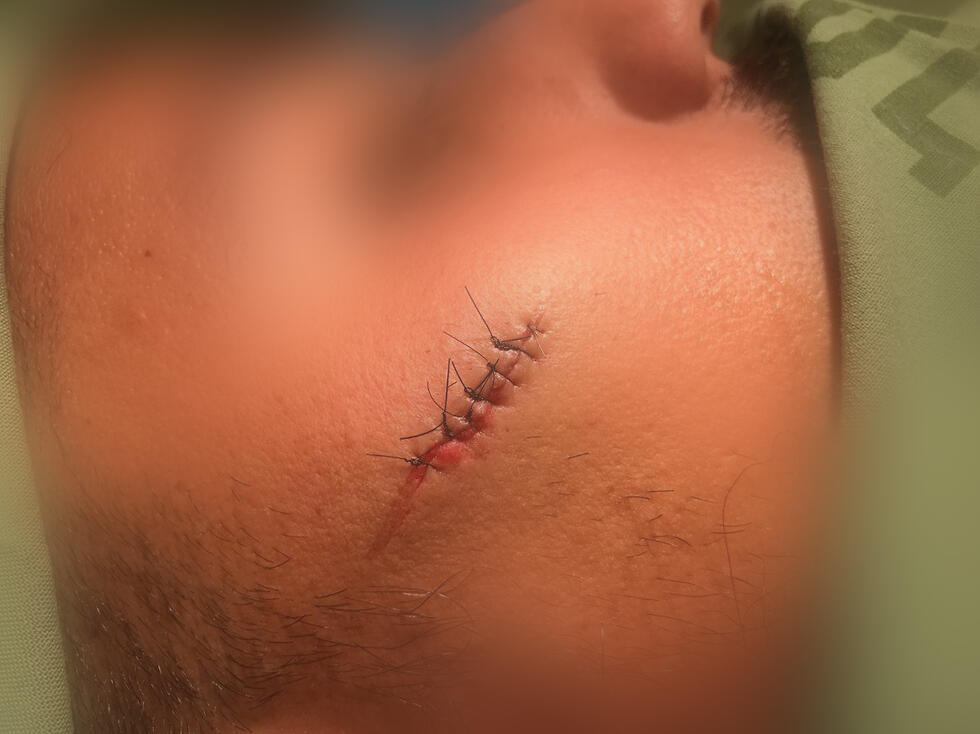 Пострадавший сотрудник Управления аэропортовnullnull Пострадавший сотрудник Управления аэропортов