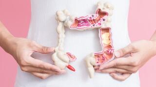 סרטן המעי הגס