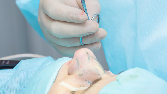 "The child is angry at the surgeon, saying he ruined his life