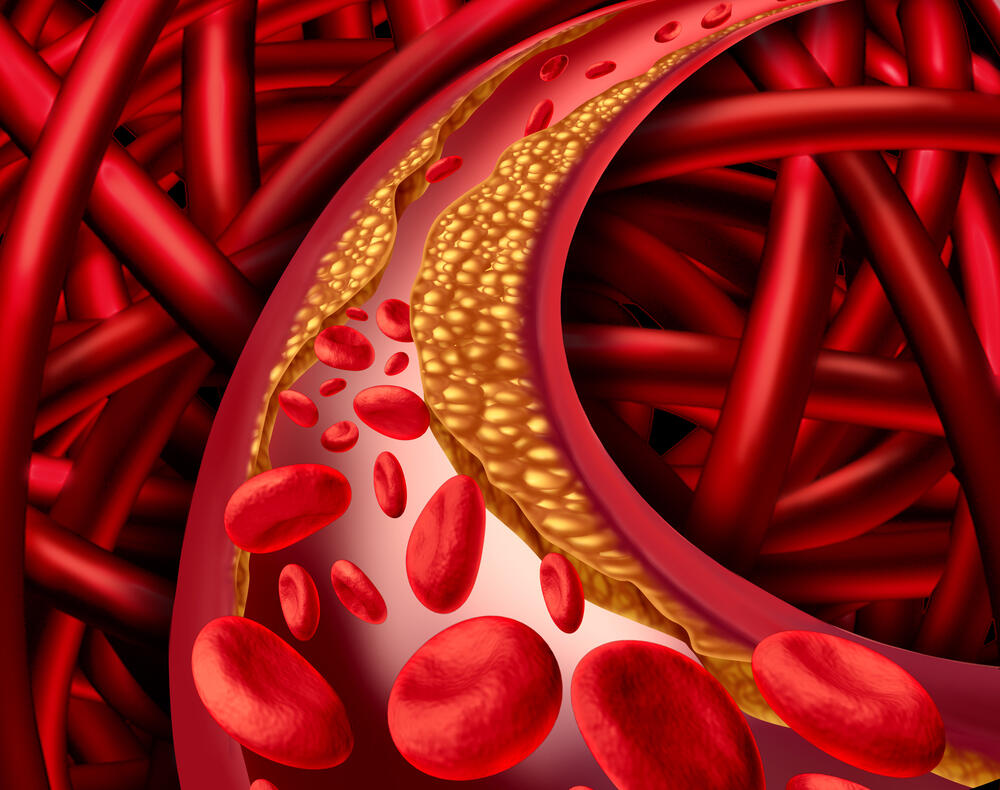 A 3D illustration of blood fats (Photo: Shutterstock) כולסטרול