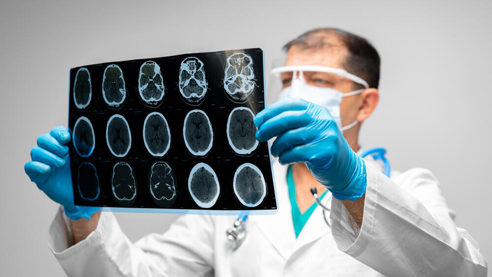 A doctor interprets an X-ray scan (Photo: Shutterstock) רופא מפענח צילום רנטגן דימות
