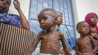 סומליה רעב משבר מזון מרכז לטיפול ב תת תזונה מוגדישו