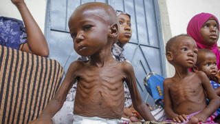 סומליה רעב משבר מזון מרכז לטיפול ב תת תזונה מוגדישו