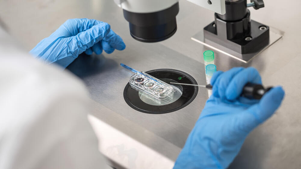 DNA tests conducted on 11 of the children strengthened the suspicion that the donors chosen were not the ones used (Photo: Shutterstock) הפריה חוץ-גופית IVF