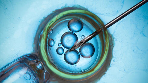 הפריה חוץ-גופית IVF