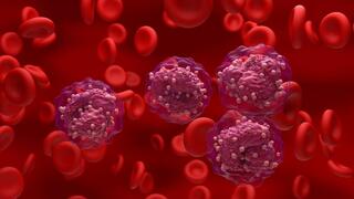 לוקמיה סרטן הדם