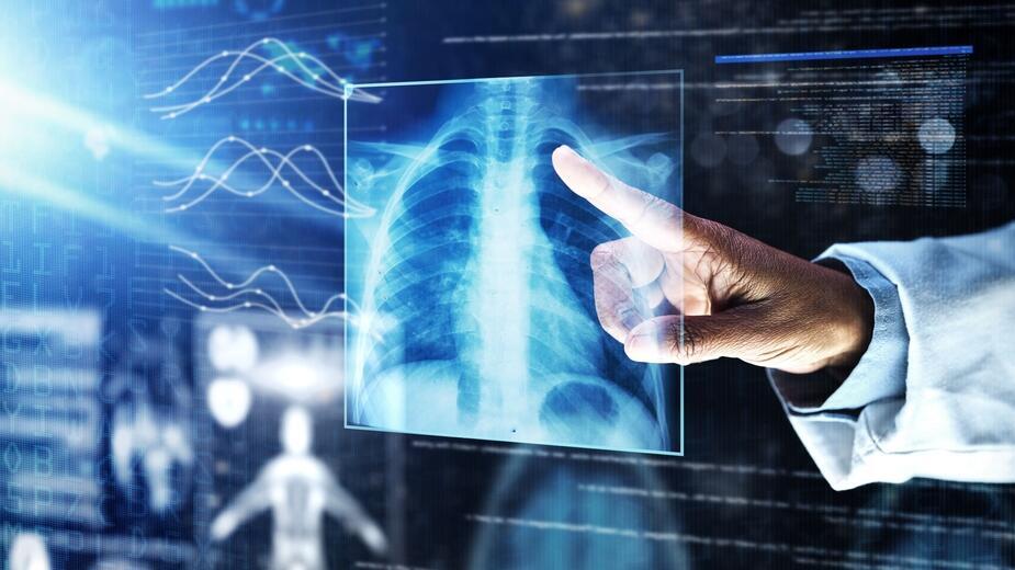 סרטן ריאה. אילוסטרציה 