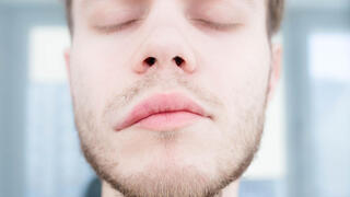 א-סימטריה בפנים בעקבות שבץ מוחי