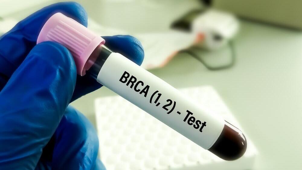 Тест на мутацию BRCA (Фото: shutterstock) בדיקה לאיתור מוטציה בגן BRCA