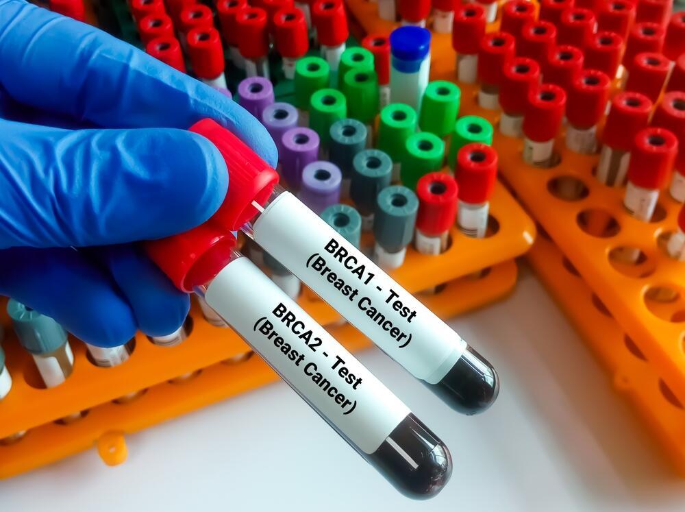 Test to detect a mutation in the BRCA gene (Photo: Shutterstock) בדיקה לאיתור מוטציה בגן BRCA