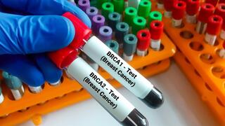 בדיקה לאיתור מוטציה בגן BRCA