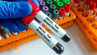 בדיקה לאיתור מוטציה בגן BRCA