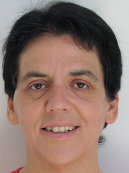 ציפי שמילוביץ 