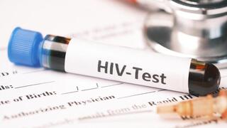 בדיקת HIV