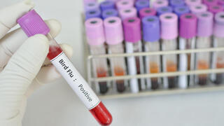 שפעת העופות