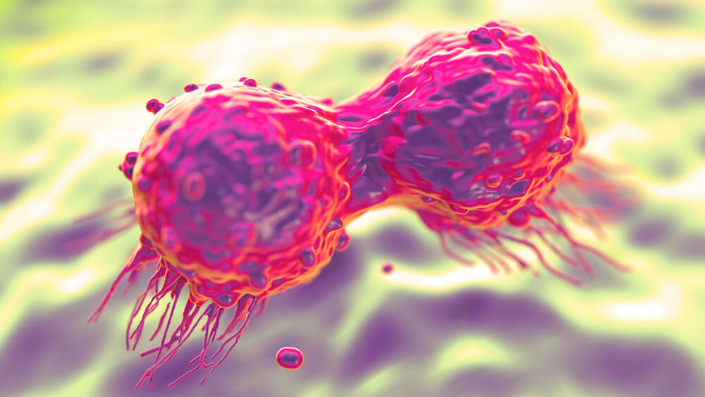 תאי סרטן השד