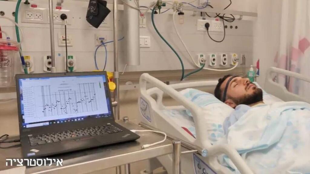 טיפול חדשני פגיעת ראש רמב"ם ד"ר דנה בר און ד"ר גודד שחף