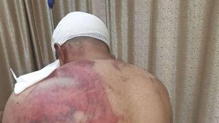 ליית' עוינה, הותקף על ידי 9 חשודים