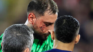 ג'אנלואיג'י דונארומה