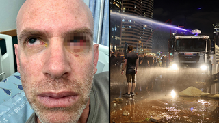 מיכאל פיש, מפגין באיילון איבד עין מהמכתזית ותובע את משטרת ישראל