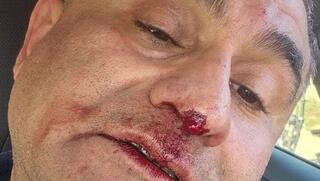 גבר תקף באופן אקראי תושב כפר קרע ופצע אותו בפניו ובידיו, המשטרה הודיעה כי החשוד "ככל הנראה ברח ממוסד רפואי לבריאות הנפש", ושהרקע לאירוע פלילי. החשוד נעצר, המשטרה ביקשה להאריך את מעצרו בבית המשפט והוא נלקח לחקירה.