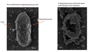 הנגיף נצמד לתא החיידק (בתמונה השמאלית) וממית אותו (מימין)