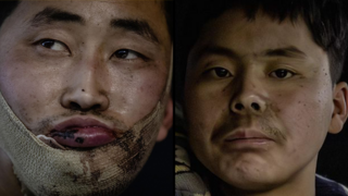 חיילים צפון קוריאנים שנשבו באוקראינה