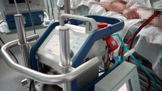 החייאה באמצעות מכשיר אקמו ECMO שמדמה פעולת לב-ריאה