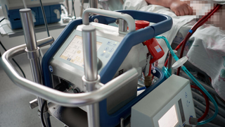 החייאה באמצעות מכשיר אקמו ECMO שמדמה פעולת לב-ריאה