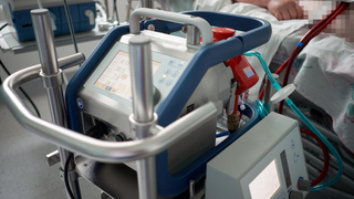 החייאה באמצעות מכשיר אקמו ECMO שמדמה פעולת לב-ריאה